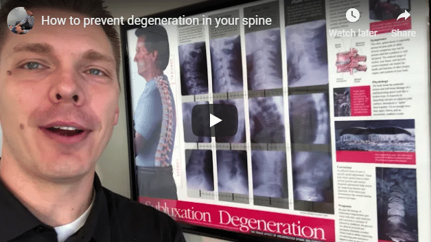 Roseville Chiropractor Explains How to Prevent Degeneration in Your Spine